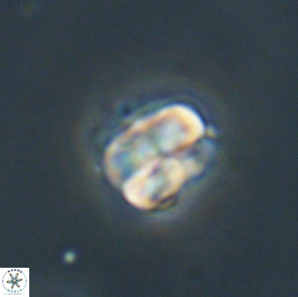 Heliolithus aktasii 66529