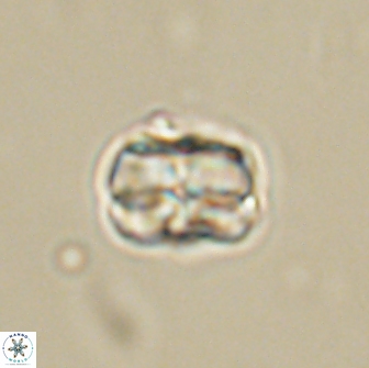 Heliolithus aktasii 66521