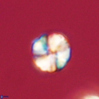 Heliolithus aktasii 66535