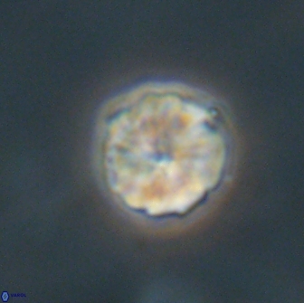 Heliolithus aktasii 66530