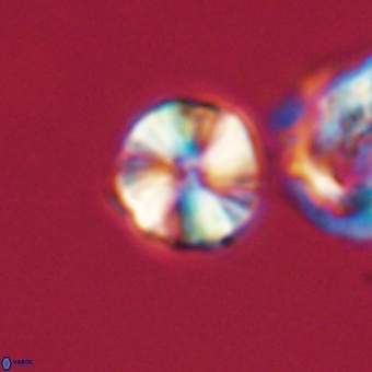 Heliolithus aktasii 66547