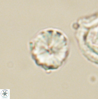 Heliolithus aktasii 66549