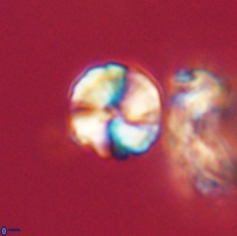 Heliolithus aktasii 66541