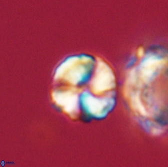 Heliolithus aktasii 66542