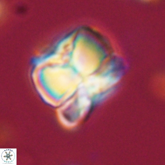 Heliolithus aktasii 68888