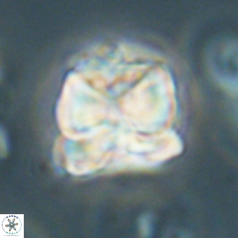 Heliolithus aktasii 68895