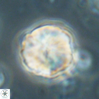 Heliolithus aktasii 68896