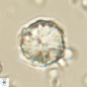 Heliolithus aktasii 68897