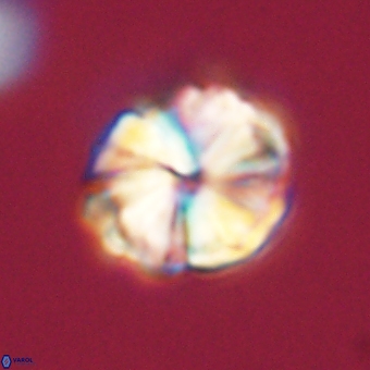 Heliolithus aktasii 68905