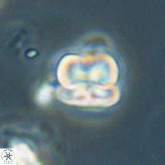 Heliolithus aktasii 68925