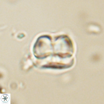 Heliolithus aktasii 68926