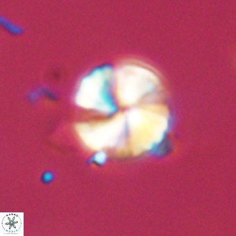 Heliolithus aktasii 68934