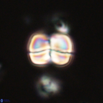 Heliolithus aktasii 69194