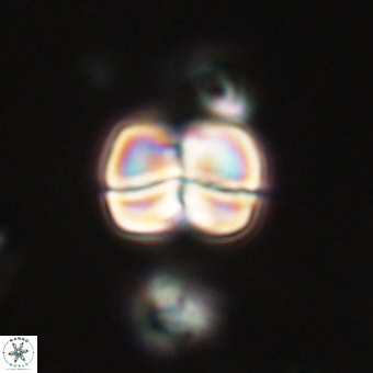 Heliolithus aktasii 69194