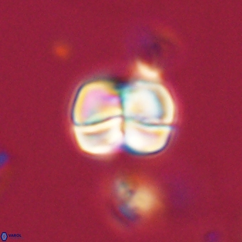 Heliolithus aktasii 69196