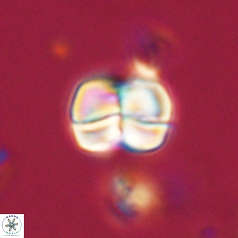 Heliolithus aktasii 69196