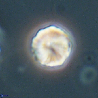 Heliolithus aktasii 69214