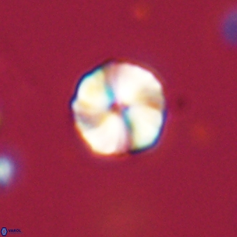 Heliolithus aktasii 69219