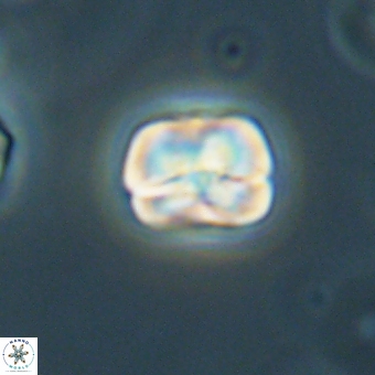 Heliolithus aktasii 69213
