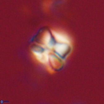 Heliolithus aktasiii 20863