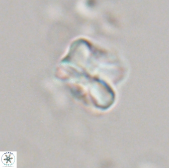Heliolithus aktasiii 20865