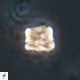 Heliolithus aktasiii 20868
