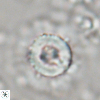 Heliolithus bukryi 21185