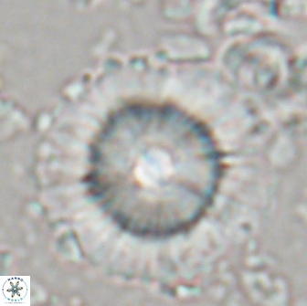 Heliolithus bukryi 21187