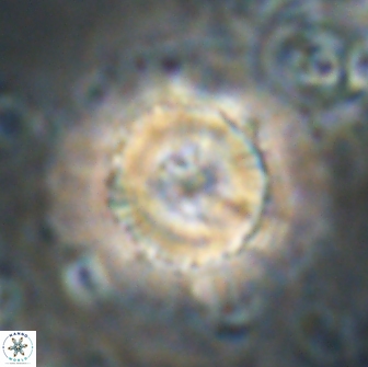 Heliolithus bukryi 21189