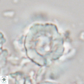 Heliolithus bukryi 21209
