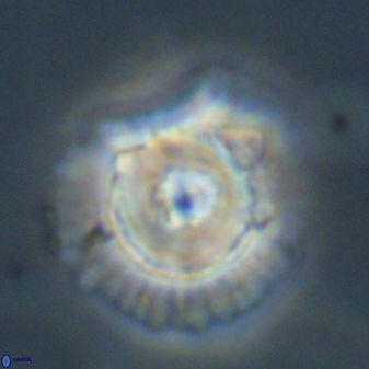 Heliolithus bukryi 55410