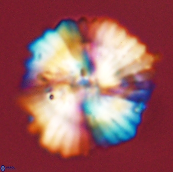 Heliolithus bukryi 55613