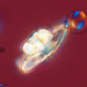 Heliolithus bukryi 55369