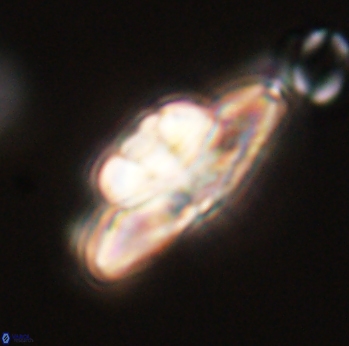 Heliolithus bukryi 55370