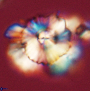 Heliolithus bukryi 59194