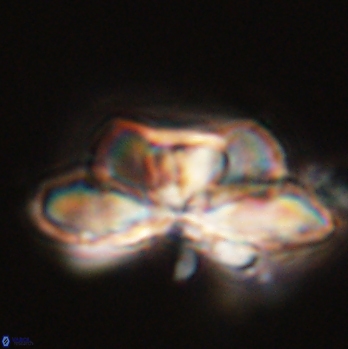 Heliolithus bukryi 59197