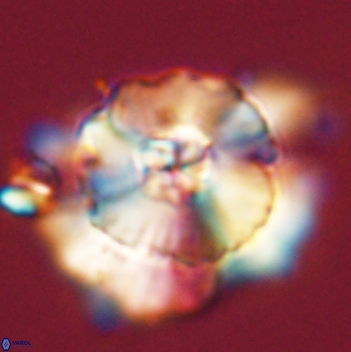 Heliolithus bukryi 59208