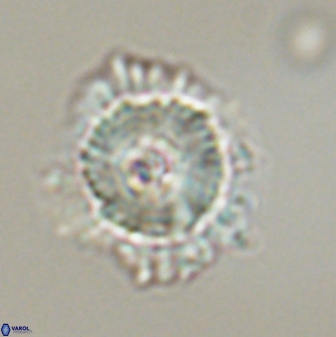 Heliolithus bukryi 59289
