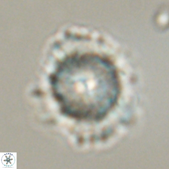 Heliolithus bukryi 59291