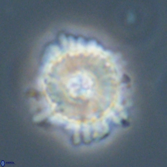 Heliolithus bukryi 59297