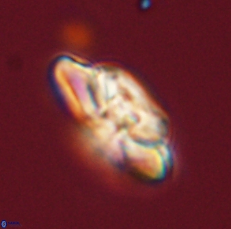 Heliolithus bukryi 59302
