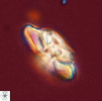 Heliolithus bukryi 59302