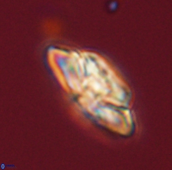 Heliolithus bukryi 59305