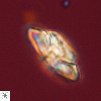 Heliolithus bukryi 59305