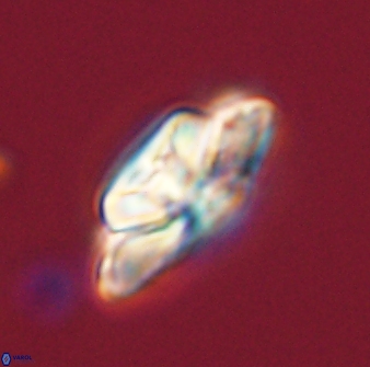 Heliolithus bukryi 59306
