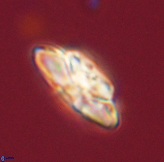 Heliolithus bukryi 59310