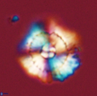 Heliolithus bukryi 59314