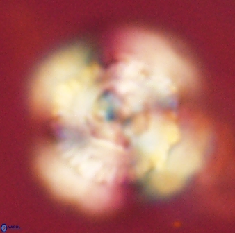 Heliolithus bukryi 62521