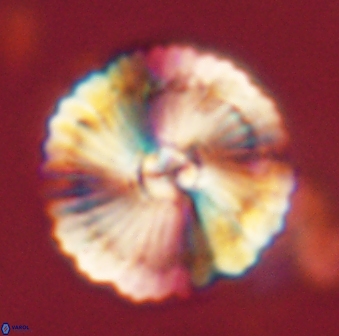 Heliolithus bukryi 62524