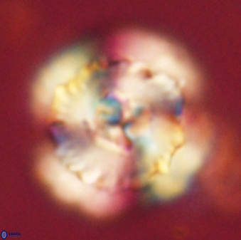 Heliolithus bukryi 62526